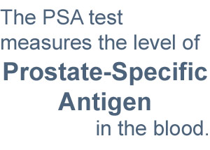 PSA Test